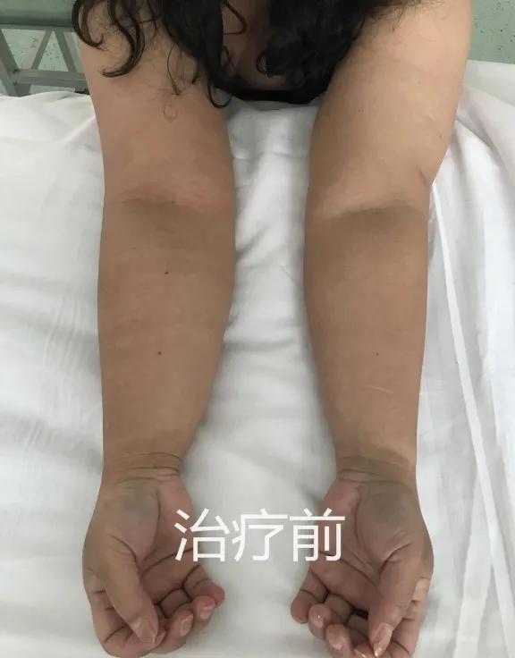 开封市中心医院乳腺甲状腺科,汕头市中心医院甲状腺外科