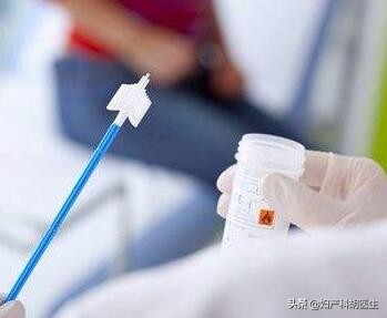 宫颈TCT怎么做,宫颈TCT报告怎么看