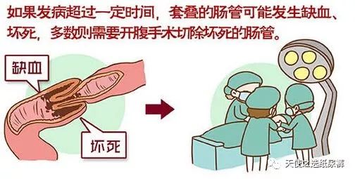 妈妈亲历，肠套叠差点要了我孩子的命！