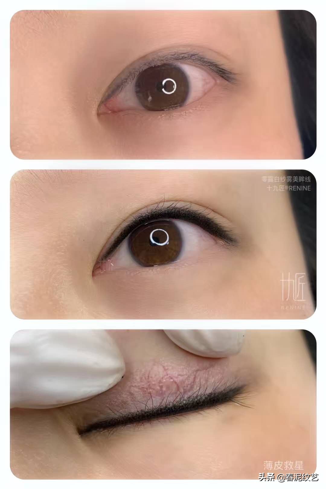 美瞳线麻药灼伤眼睛处理方法,美瞳线过后红肿怎么处理