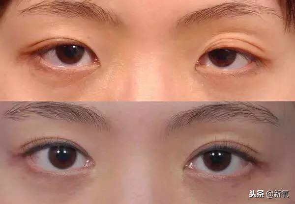 辛芷蕾是苦相女生吗,辛芷蕾气质怎么养成