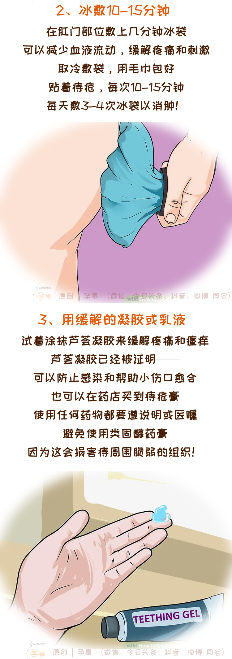 怀孕分娩后痔疮大爆发，三个步骤正确护理缓解疼痛