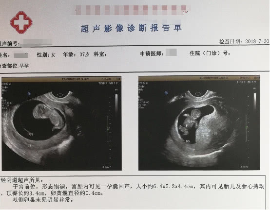 优秀的单身女性选择海外买精定制宝宝，网友称这是人类发展的趋势