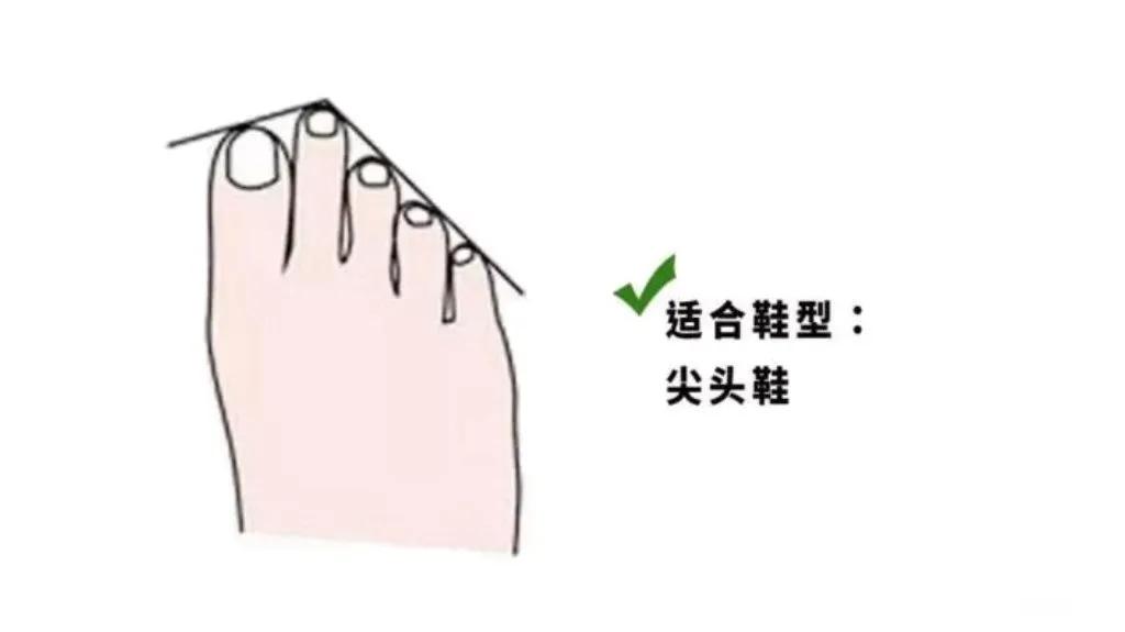 夏天穿凉鞋的季节，不懂脚型，选错鞋子又丑又磨脚！