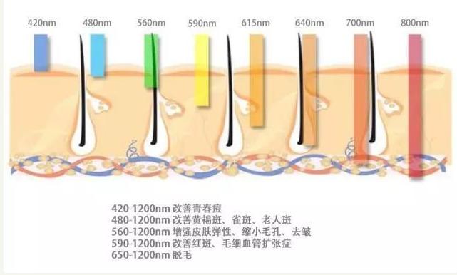 m22光子嫩肤的功效和作用,m22光子嫩肤的功效和作用价格