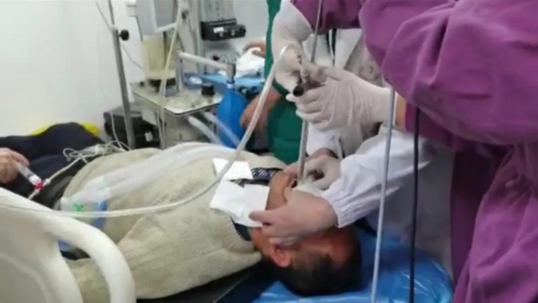 硬质支气管镜是什么手术,超导可视支气管镜介入治疗