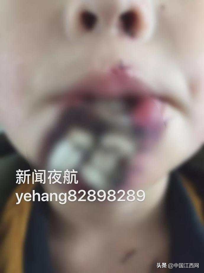 七岁男孩模仿游戏,男童模仿吃鸡游戏佩戴头盔摔倒