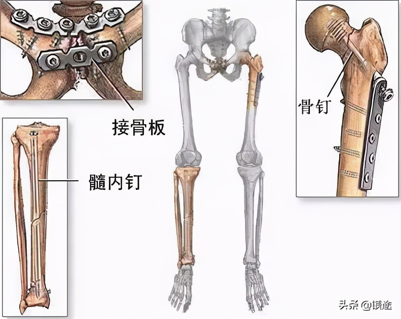 金属镁产业发展,镁金属发展前景