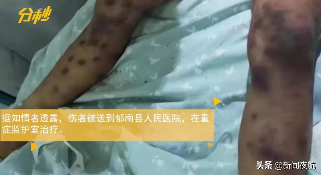 江西女子被蜂群袭击视频,江西女子遭蜂群猛攻后续