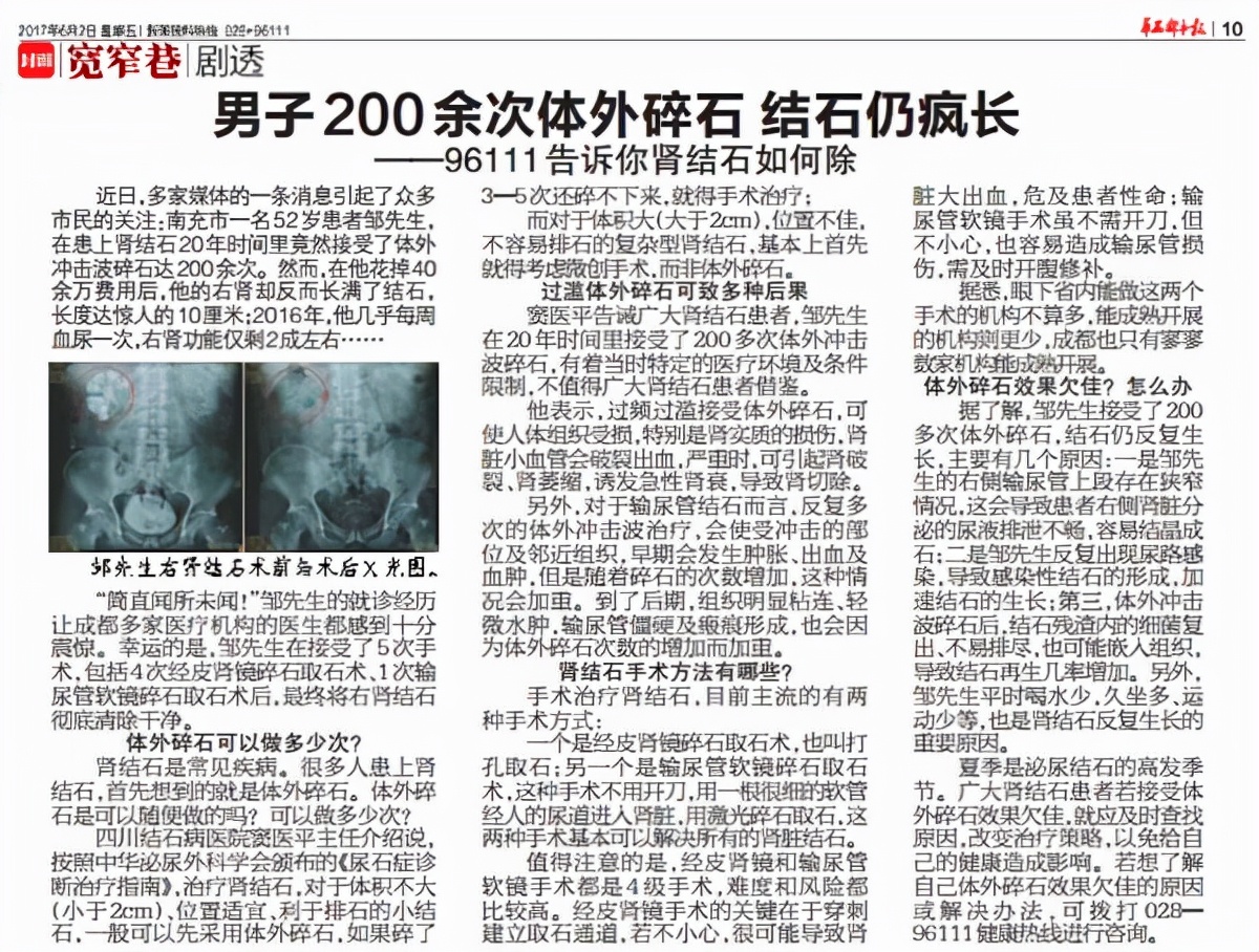 做完体外碎石为什么总大便,体外碎石后出现结石的原因