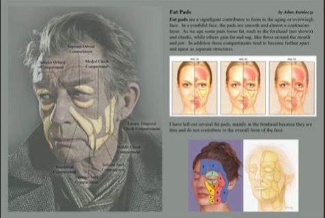 法令纹去除应该填充还是去皱,法令纹除了填充就没其他方法了吗