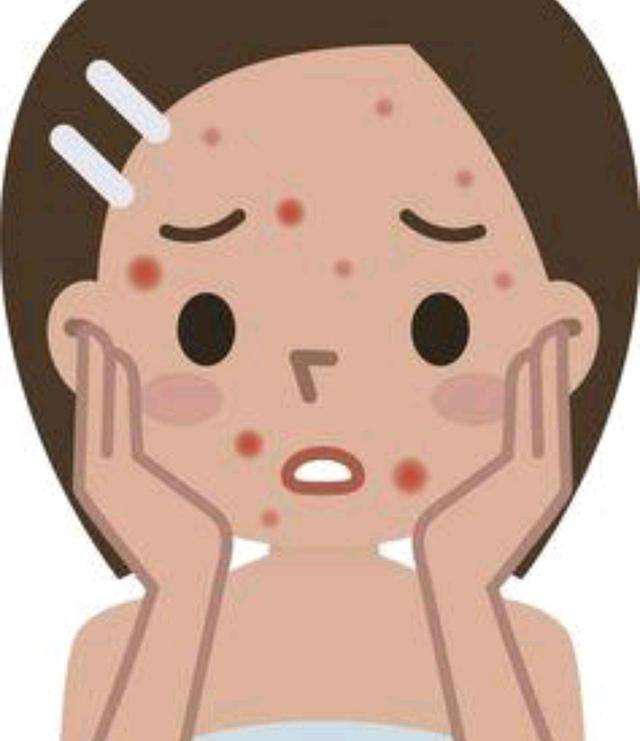 孕期痘痘你们都是怎么处理,孕期痘痘如何护理干净痘印