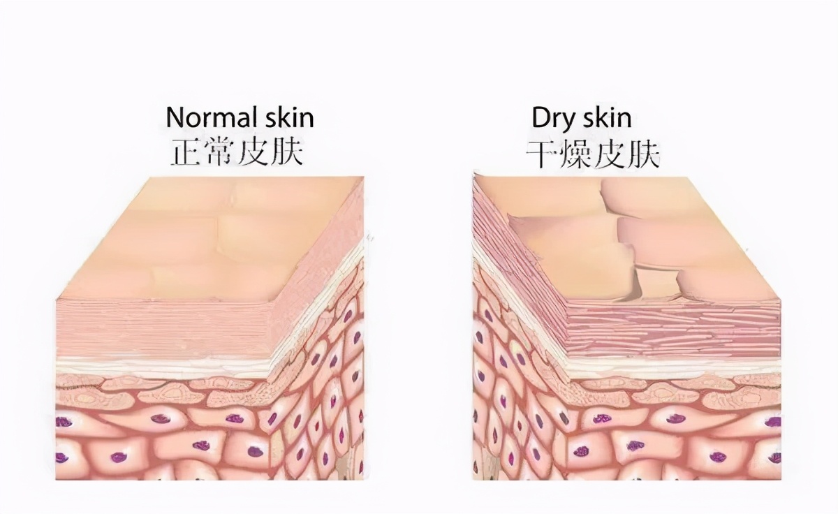 干皮换季长痘起皮,皮肤干燥起皮泛红长痘修复屏障