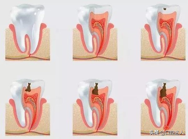 一直犹豫种不种牙，有什么建议吗？