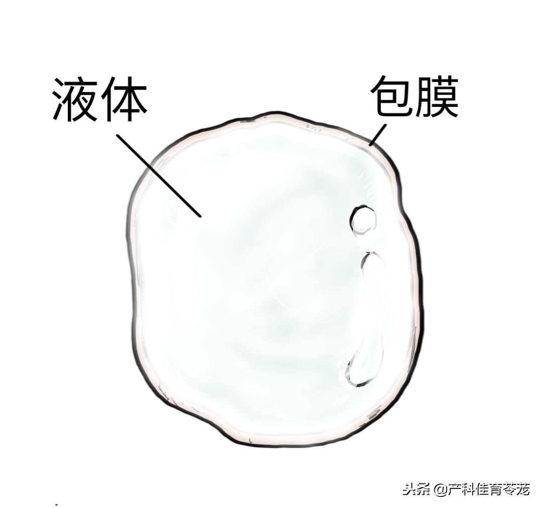 卵巢囊肿做了肿瘤标志物显示正常,卵巢囊肿内见密集光点正常吗