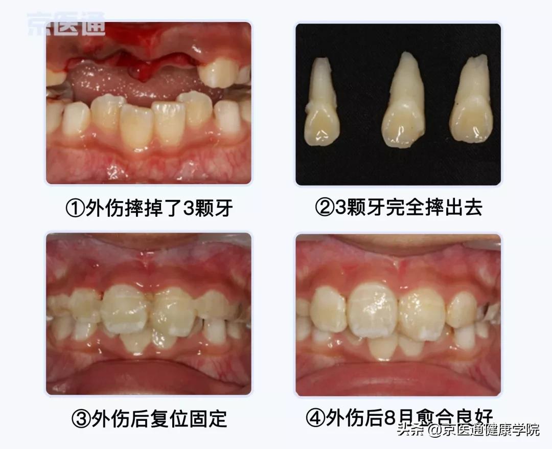 运动前怎么预防损伤,运动之前涂什么预防受伤