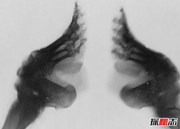 真实的三寸金莲真的好看吗,三寸金莲真的美吗