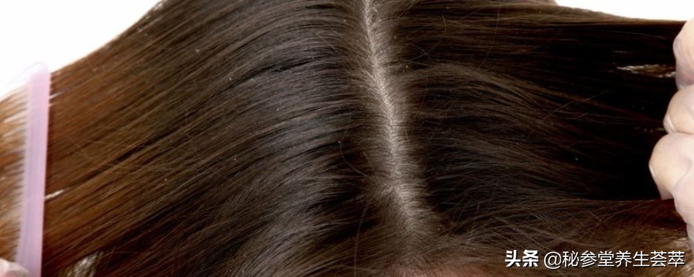 头发毛躁开叉怎么办试试这些方法,头发毛躁分叉怎么彻底解决