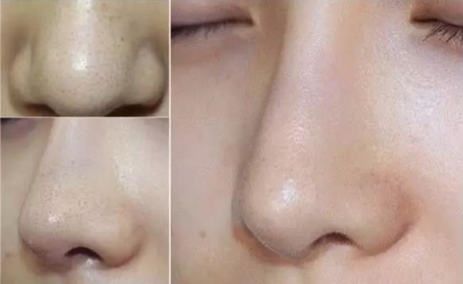 赵丽颖皮肤毛孔粗大图片,赵丽颖无美颜无滤镜最真实的模样