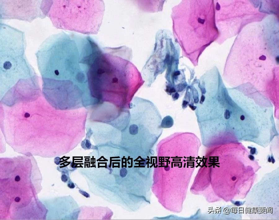 打过宫颈癌针需要查有没有抗体吗,35-45岁打宫颈癌疫苗最适合打几价