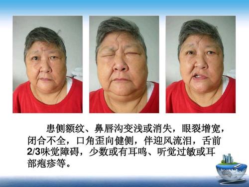 灏忎腑椋庝腑鍖昏兘鏍规不濂藉悧,涓尰娌绘剤浜嗗皬涓