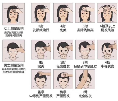 刘海可以盖住发际线的发型,适合发际线高并且没有刘海的发型