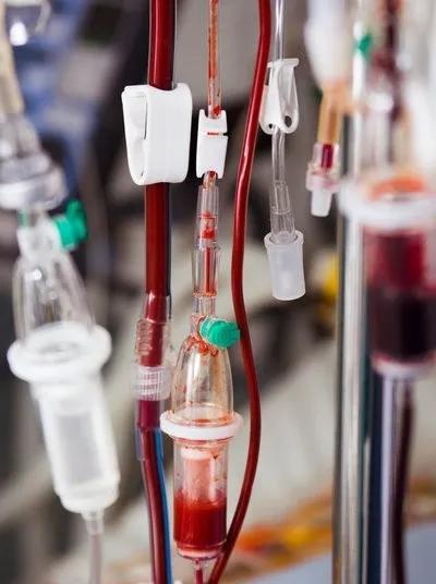 癌症晚期输血对于肿瘤有利有弊,恶性肿瘤病人是否需要输血