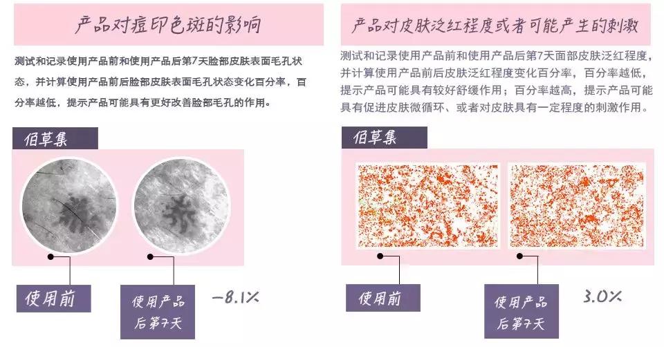 最好用的美白精华测评,国货美白淡斑精华