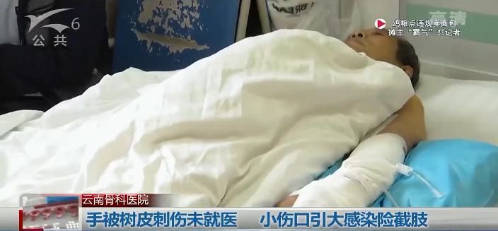 好可怕！老师傅手臂肿成这样险些截肢，只是因为被树皮扎了个小口子