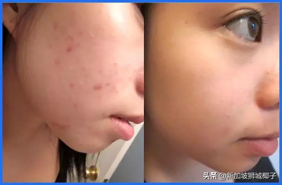 马来西亚药妆店必买,新加坡日本药妆