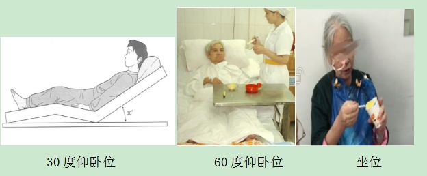 战疫情：居家吞咽康复在行动（居家康复指导系列一）