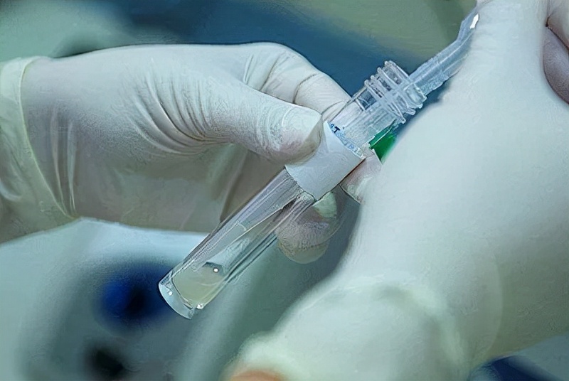 精子总数少于多少算少精子症,男性精子少