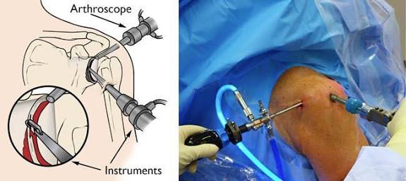 肩膀疼痛竟是如此大问题不可小觑,肩膀疼痛的辨别和解决方法