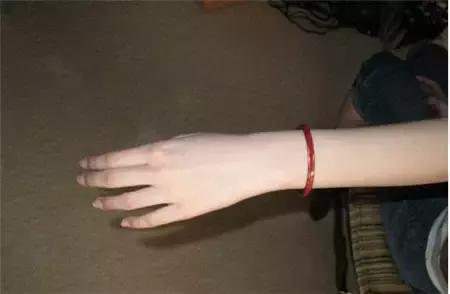 翡翠手镯摘不下来妙招,翡翠手镯自己取不下来怎么办