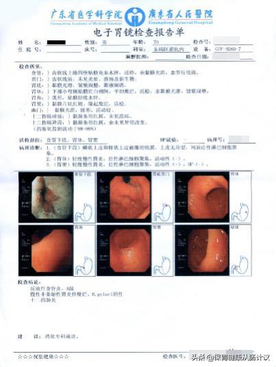 萎缩性胃炎你需要知道的5个点,萎缩性胃炎很吓人看完你就懂了