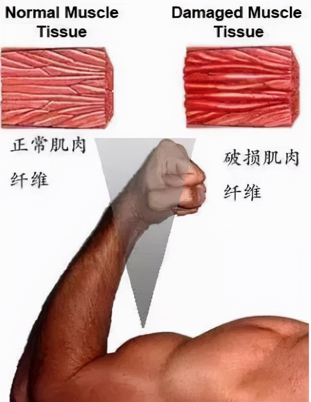 健身过度肌肉酸痛脖子僵怎么缓解,健身肌肉酸痛还能继续锻炼吗