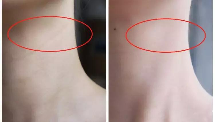 theordinary护肤品推荐,护肤圈成分theordinary