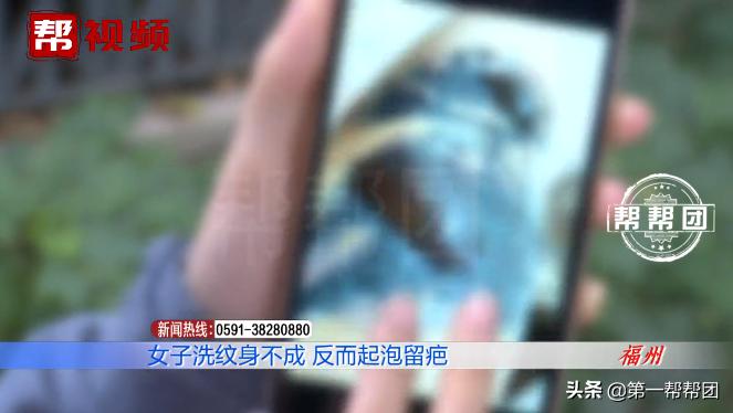 洗纹身后发炎起脓会留疤吗,洗纹身后起水泡了会留疤吗