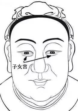 五处克夫痣一定要点掉,痣克夫是不是要点掉