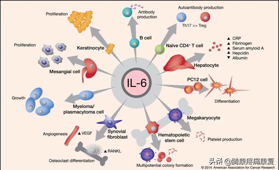理疗对骨性关节炎有什么作用,骨性关节炎炎症怎么消除