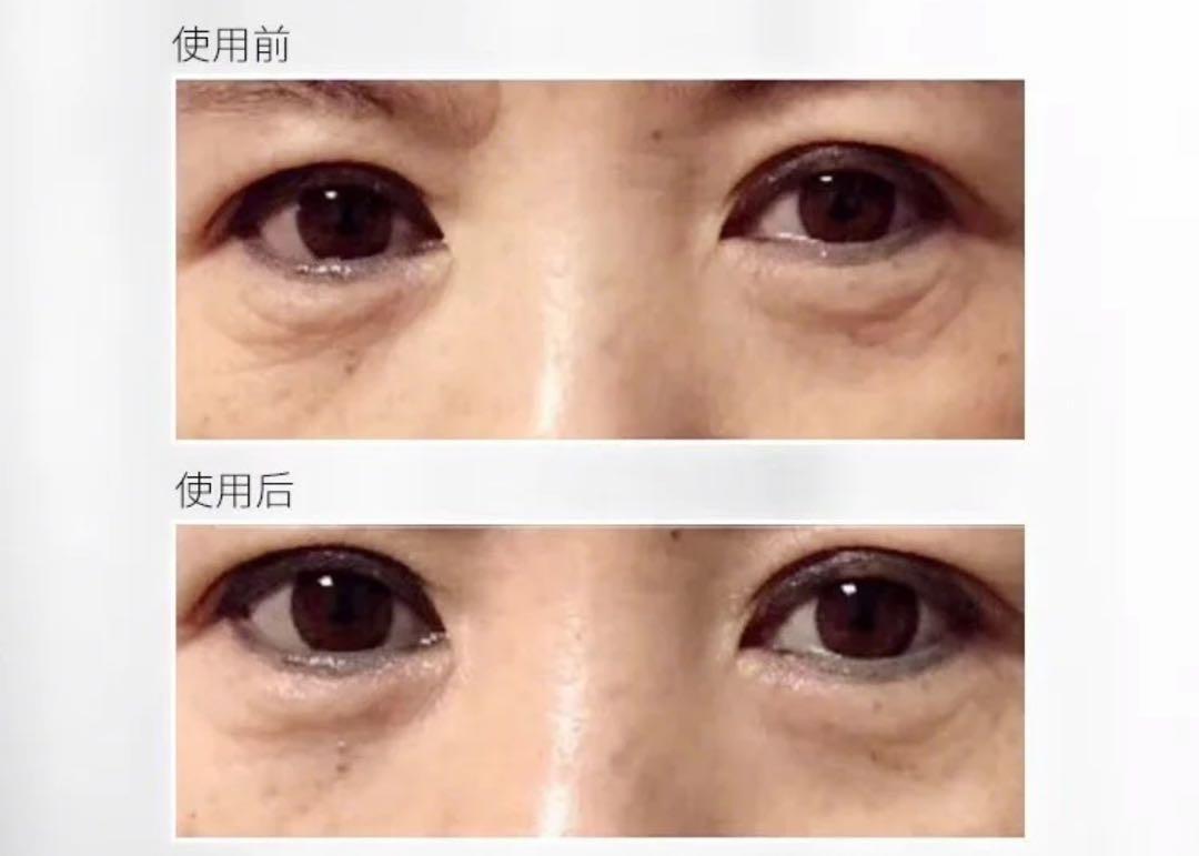 肖战王一博贴眼膜,肖战贴眼膜正确方法