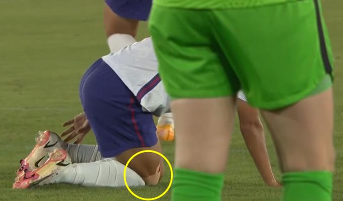 王霜受伤离场视频,王霜受伤训练视频