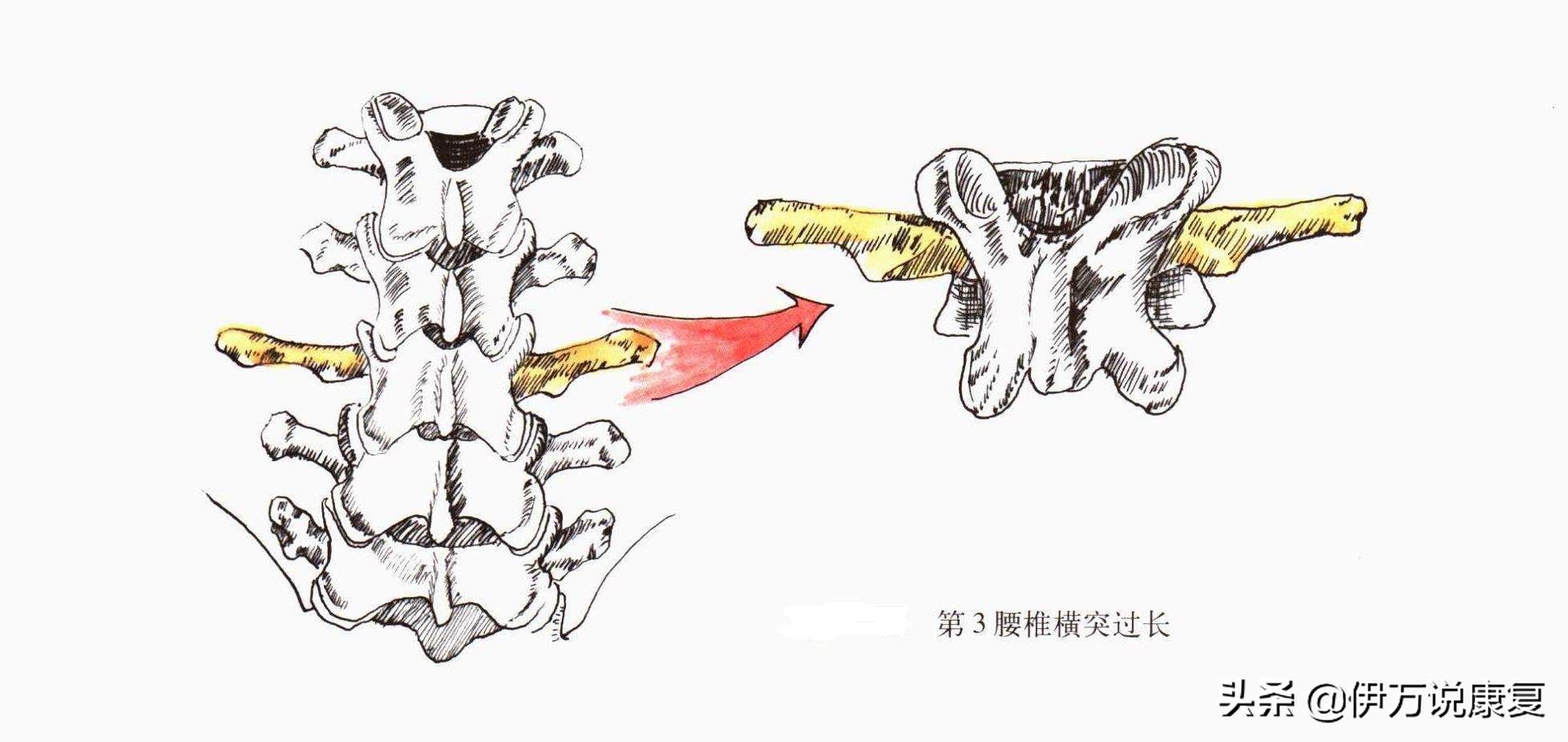 腰疼治不好怎么办,腰疼一定是腰椎出问题了吗