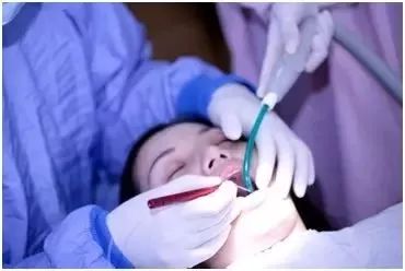 根管治疗后牙齿劈裂怎么办最好,戴冠后牙会不会劈裂