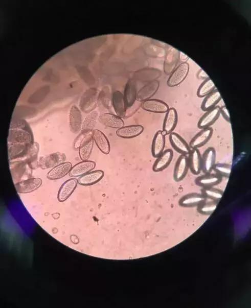 四岁女宝宝说小便地方痒用什么药,四岁女宝宝说小便地方痒和痛