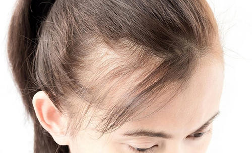 哪些食物对脱发有帮助,4种食材能有效缓解脱发