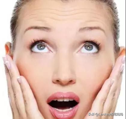 真性皱纹的定义假性皱纹的定义,一笑才有的皱纹是假性皱纹吗