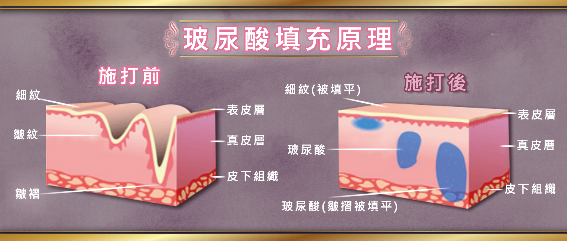 为什么说女生的钱好挣,为什么女生容易交智商税