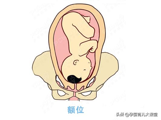 37周脐带绕颈2圈矫正图片胎位不正,孕妇胎位不正的原因及纠正方法