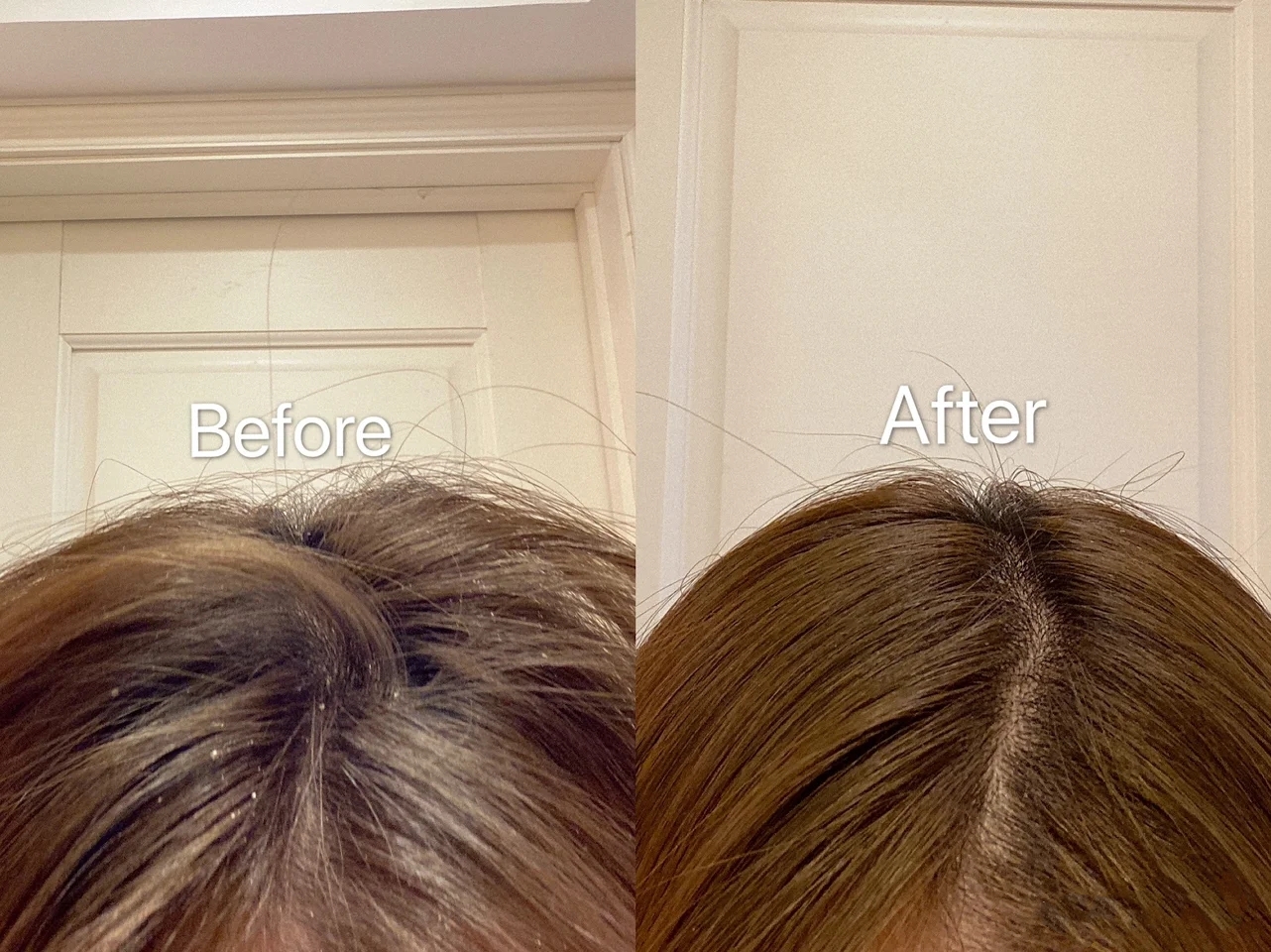 白天身上螨虫多是什么症状,身上螨虫多影响护肤吗